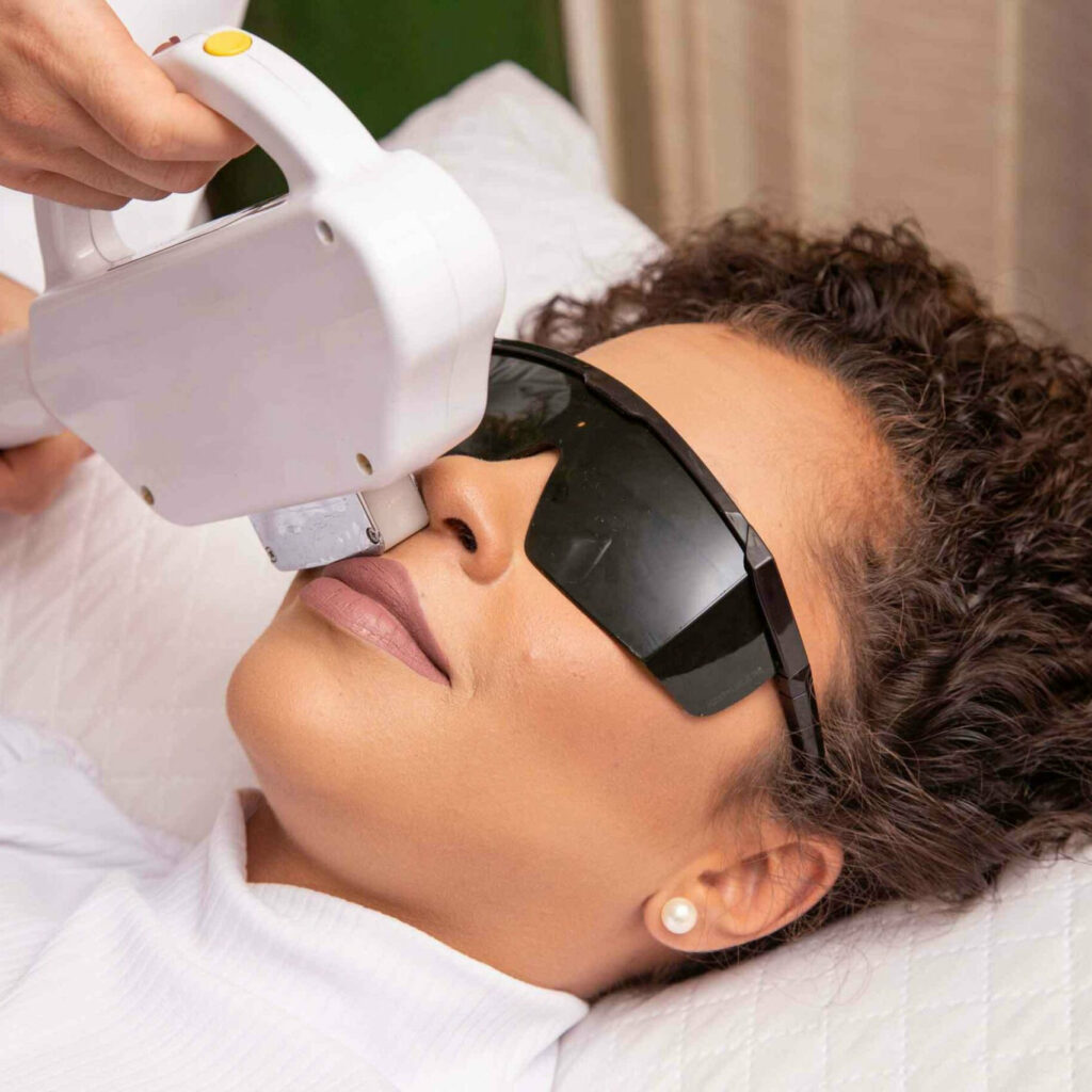 épilation définitive